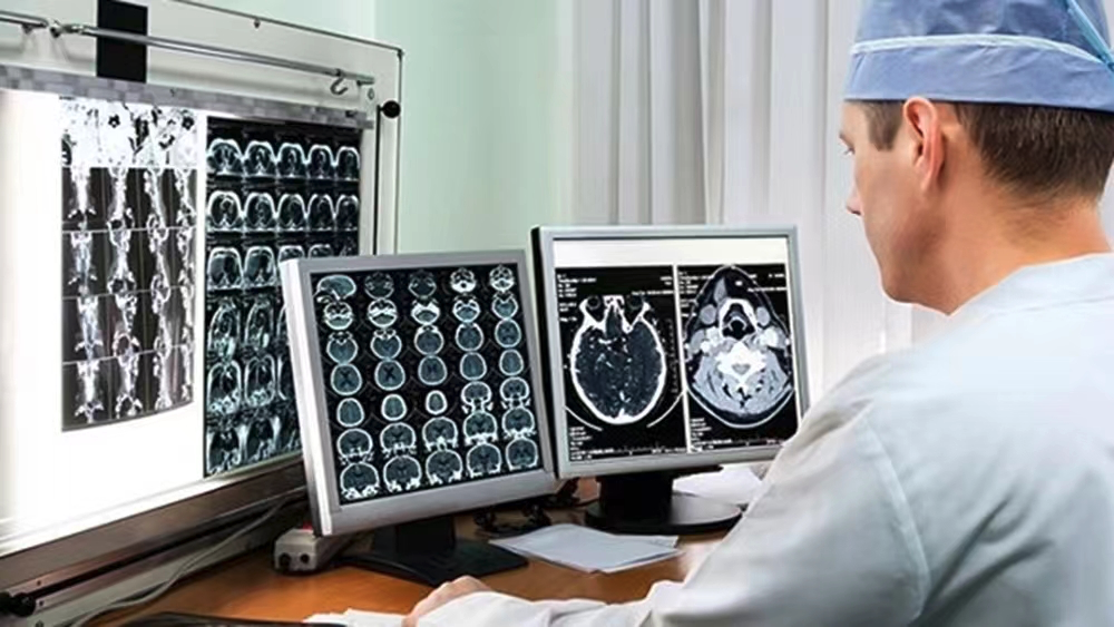 50岁后查脑ct,出现这4种问题,不需要过度治疗,别被坑了