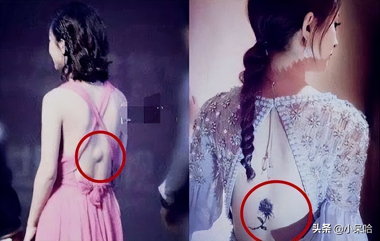 7位因拍戏深受重伤的明星，一位更比一位惨，有的至今没痊愈