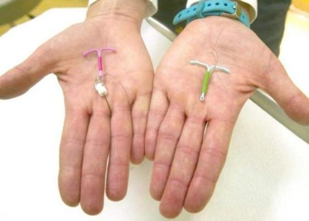 爱母环可以放多少年(节育环不取出) - 青木春