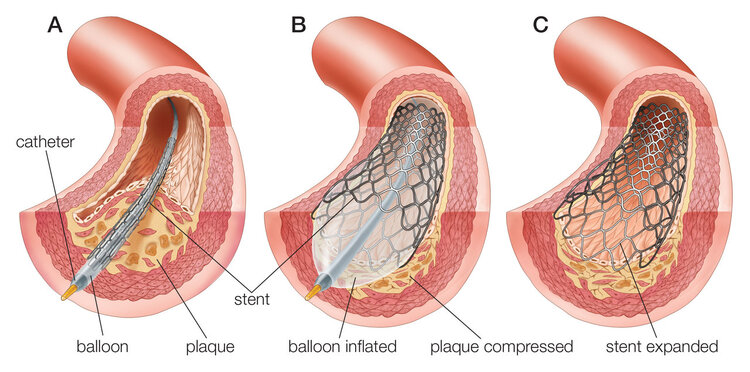 手脚容易麻是怎么回事？医生：请小心这6种大病