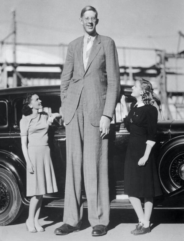 世界上最高的人（却只活到22岁，他经历了什么？）-第7张图片