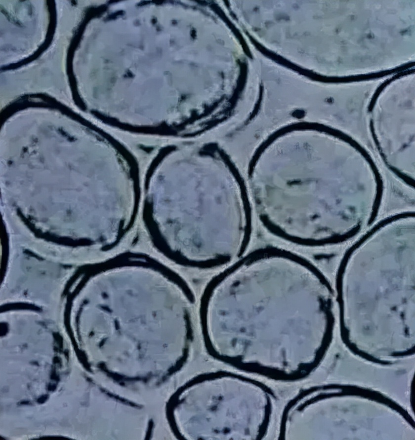 到底涤纶和聚酯纤维有没有区别？