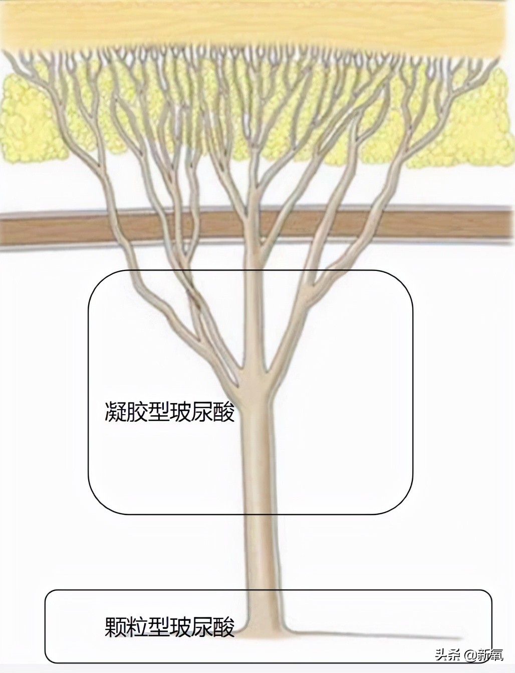 人生无常，大肠包小肠，腿精变肿精？