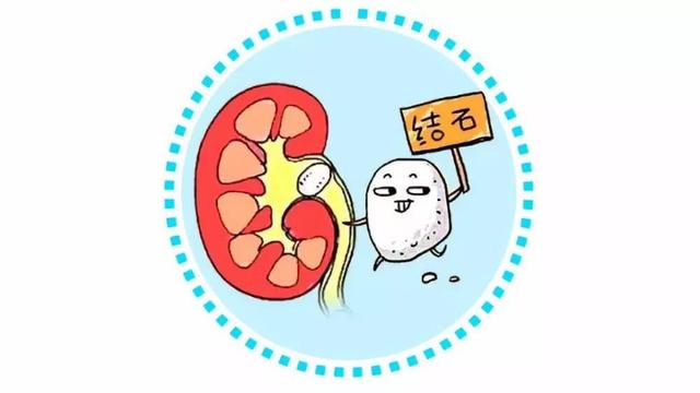 肝结石最佳治疗方法探讨