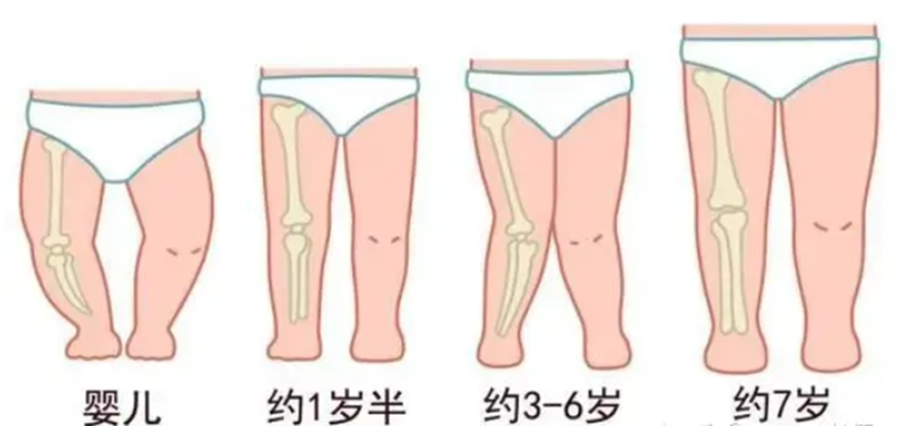 孩子腿型不好看,家长5种错误做法要背锅,及时改还来得及
