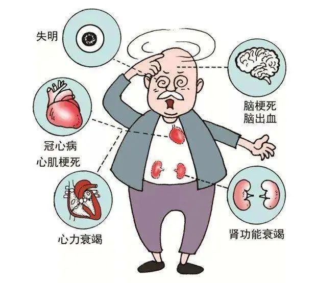 保肾 vs 肾全切，得了肾癌该如何选择？