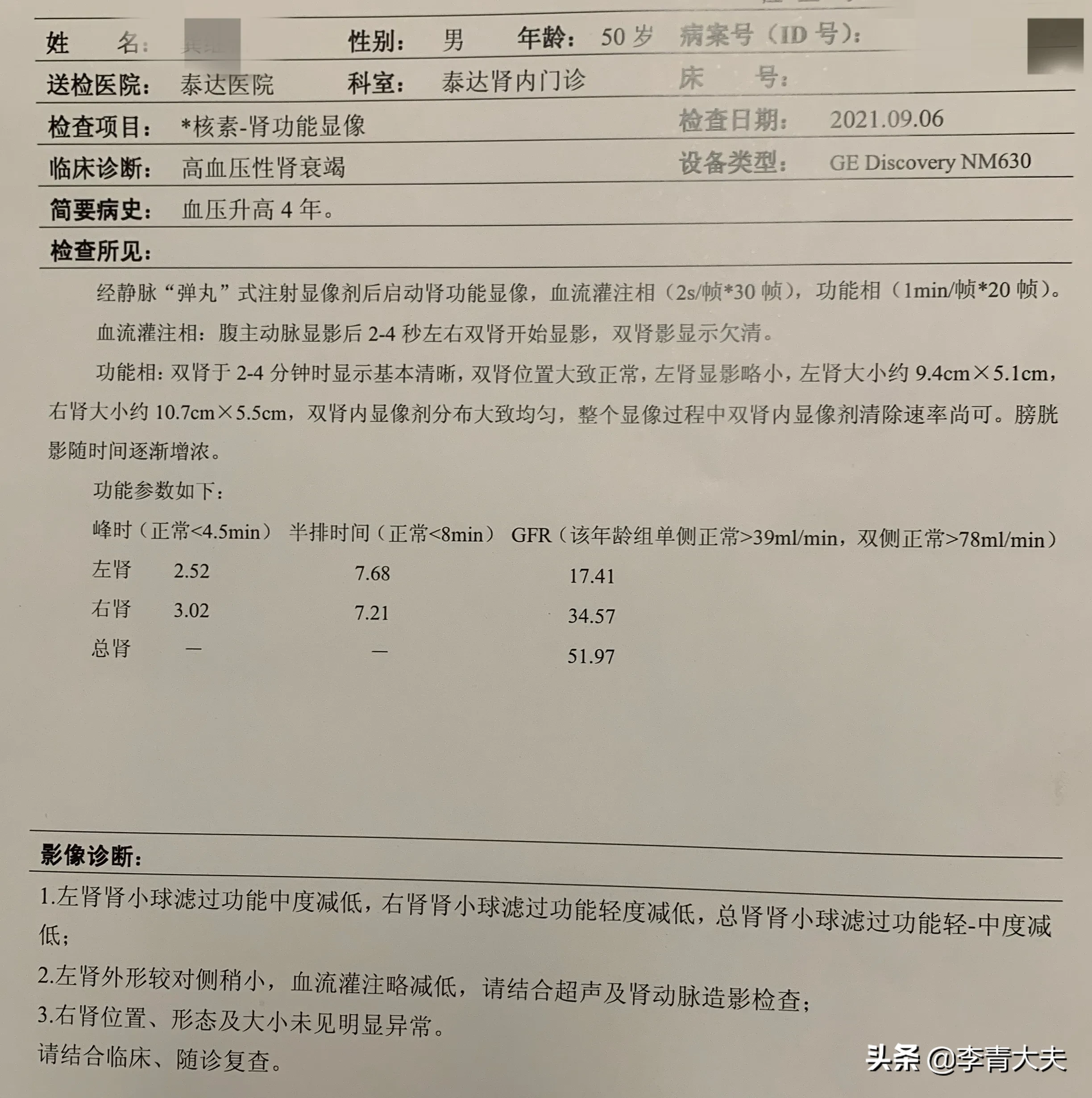 50岁的老高，在天津的东北人，16岁开始喝酒、抽烟，20多岁发现高血压，未在意