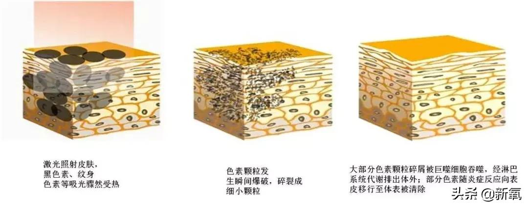 奶酷少年脸成高奢新宠模特?多亏了她满脸的雀斑…