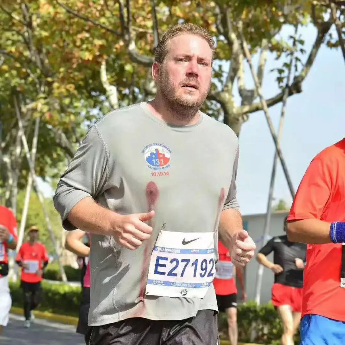 为啥无论男女,参加马拉松都要贴乳贴?没贴的人只剩尴尬和疼痛?