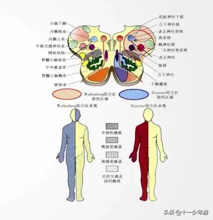 nba被动肌张力包括有哪些(运动系统解剖、生理及损害表现)