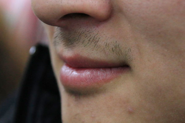 嘴唇发白、发干起皮？嘴唇的四种变化，预示着脾胃的健康变化