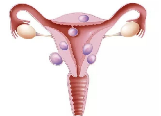 女性宫颈出现病变，腿部可能会发出“预警”，不妨留心观察下