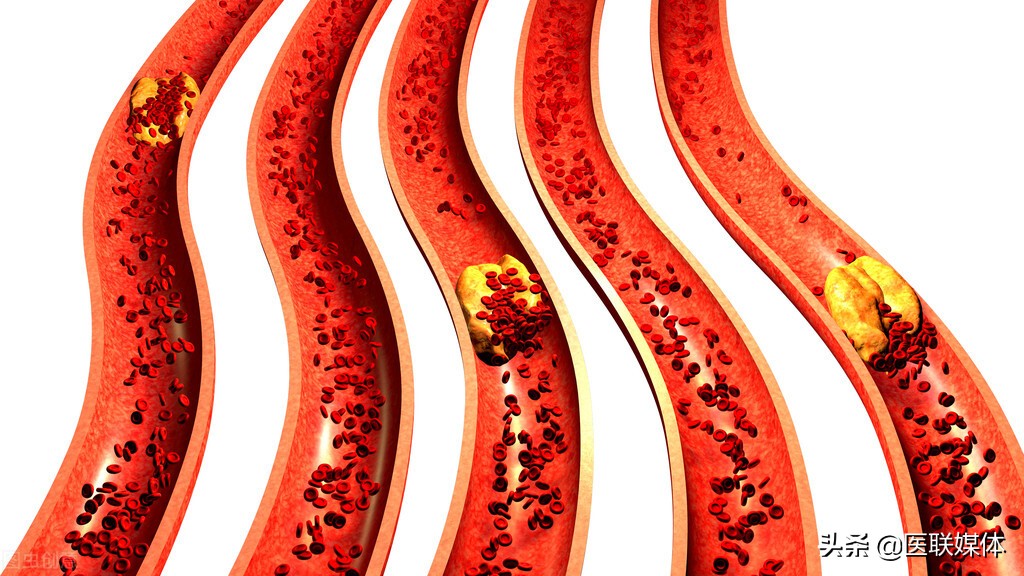 老人睡觉老是流口水？别大意了，要提防5大疾病“找上门”