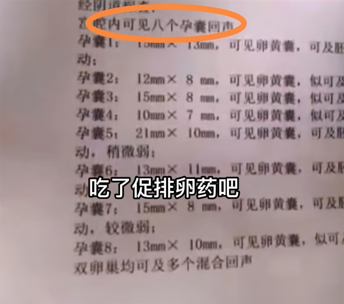 河南郑州，女子乱吃促排卵药怀上8胞胎，医生建议全打掉或者减胎