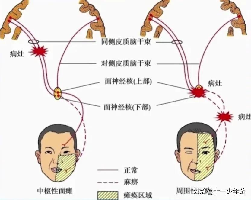 nba被动肌张力包括有哪些(运动系统解剖、生理及损害表现)