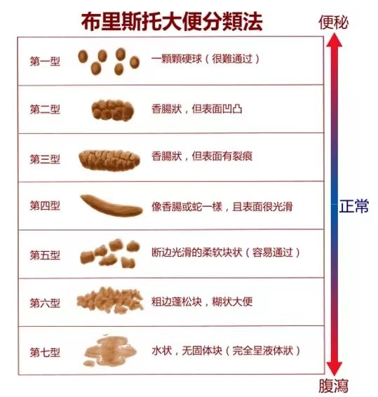 一紧张就拉肚子？你可能患上了肠易激综合征
