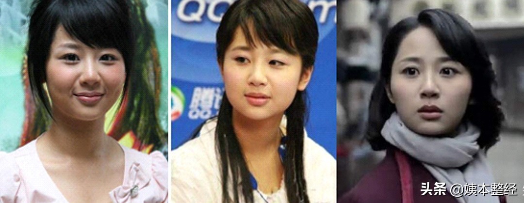 三个显土的长相特征，你中了几个？