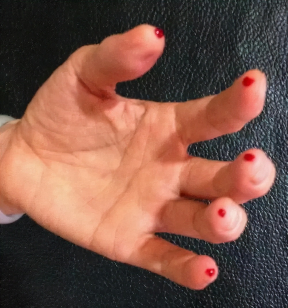 突发心梗，10种自救方法！您会选择哪几条？留言告诉王医生