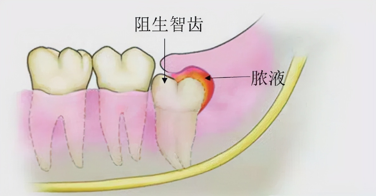 牙床是指什么部位图片