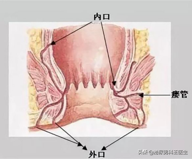 肛瘘患者：“不想治了，我真的太痛了！”肛瘘手术到底有多痛？