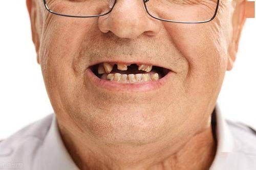 每天吃一个煮熟的苹果，坚持几天，“3个甜头”或会悄然而至