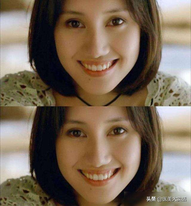 美业人必看:专业又通俗地解释为什么"一双眼睛拯救一张脸"