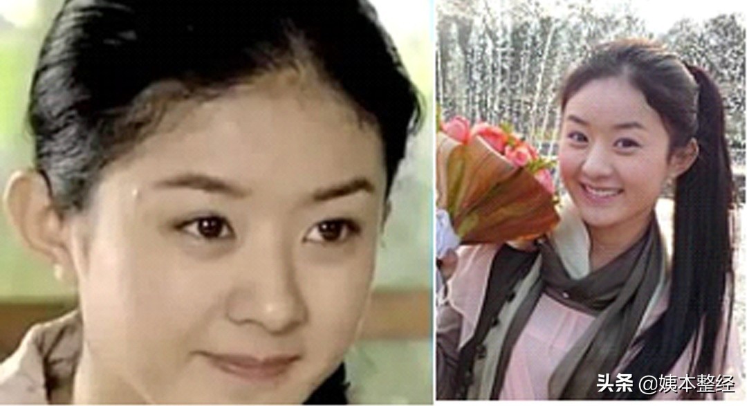 三个显土的长相特征，你中了几个？