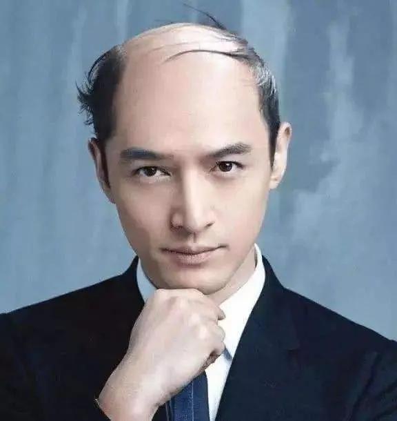 如果明星秃顶了，你还觉得他们帅吗？