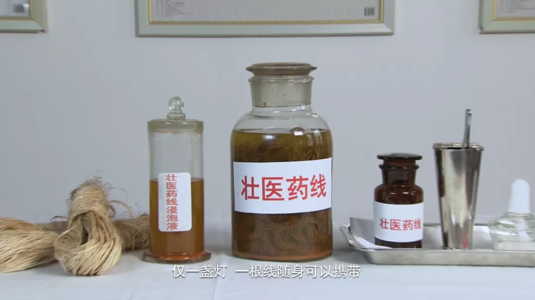 科普｜八桂中医大讲堂（22）：壮医药线点灸巧治红眼病
