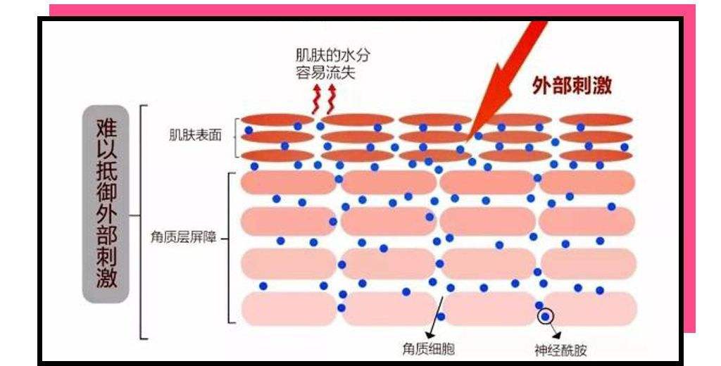 什么是皮肤屏障？皮肤屏障受损有什么表现？如何修复？