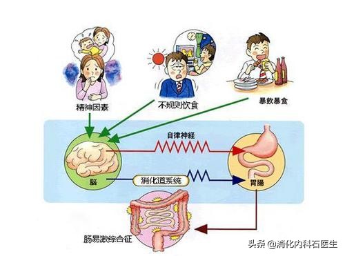 总是腹痛大便不成形，检查没问题，这个疾病你考虑了没有？