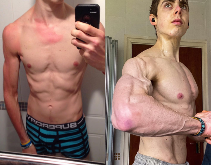 盲目锻炼或加速衰老，提醒：这5种运动方式，或让养生变伤身