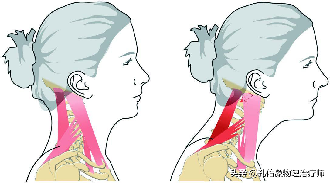 手指麻、肩胛骨疼痛，是怎么回事？出现这4个症状是颈椎发出信号