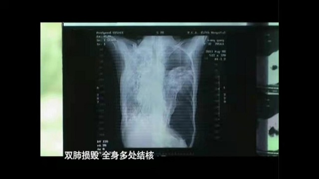 为打游戏，躲网吧10年不与父母联系，患肺痨离世前：别卖我账号