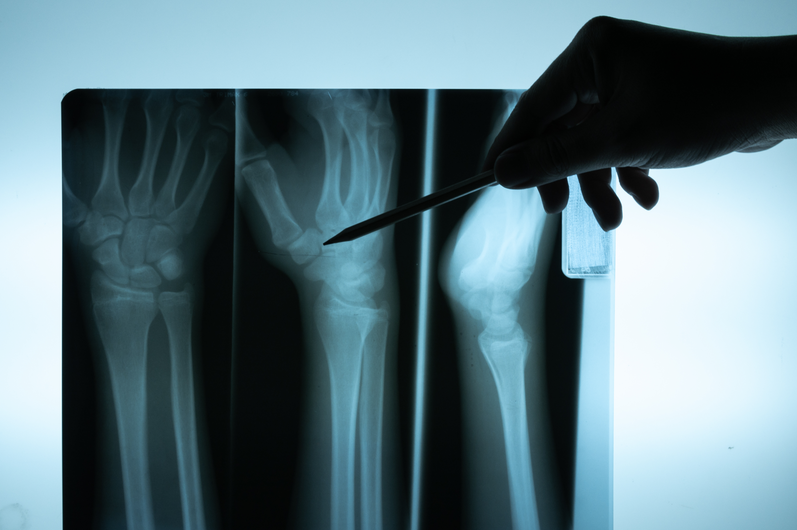 医学专业分两类，报考策略差别大，就业方向各不同