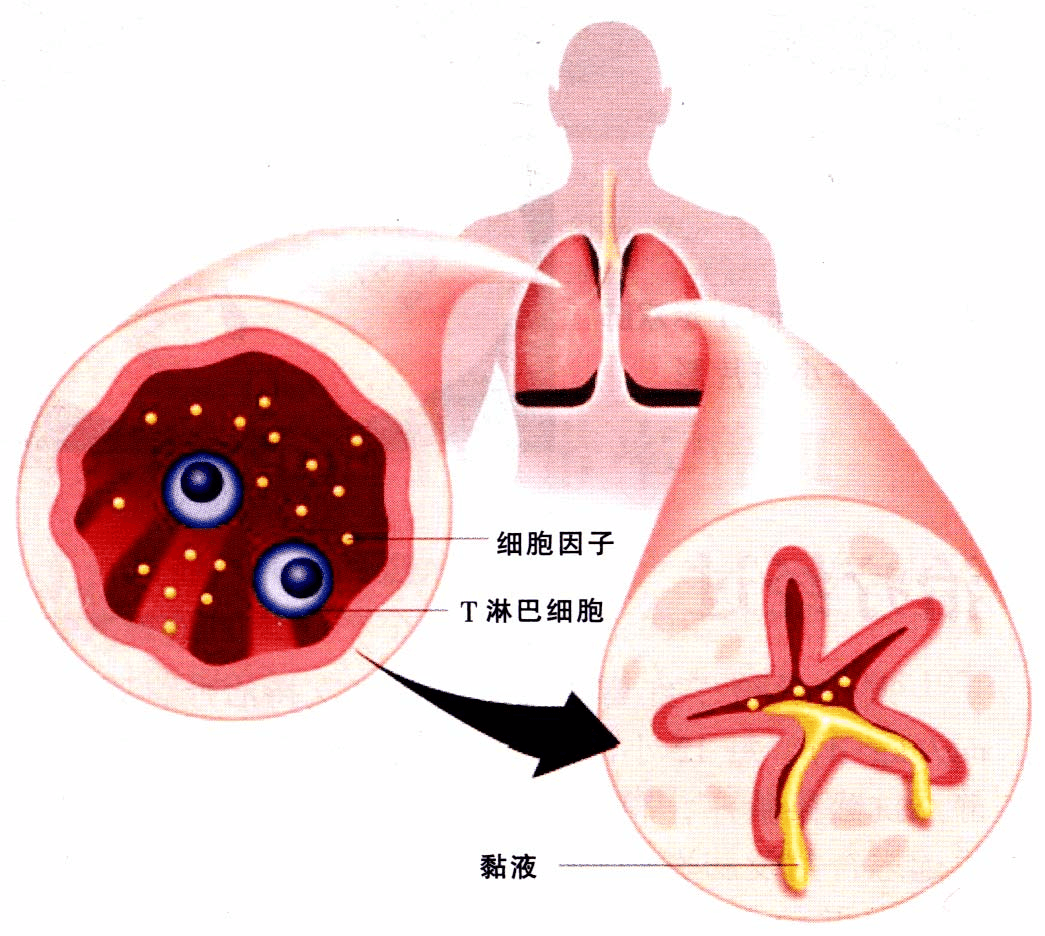 《对手》：硝酸甘油能杀人吗？
