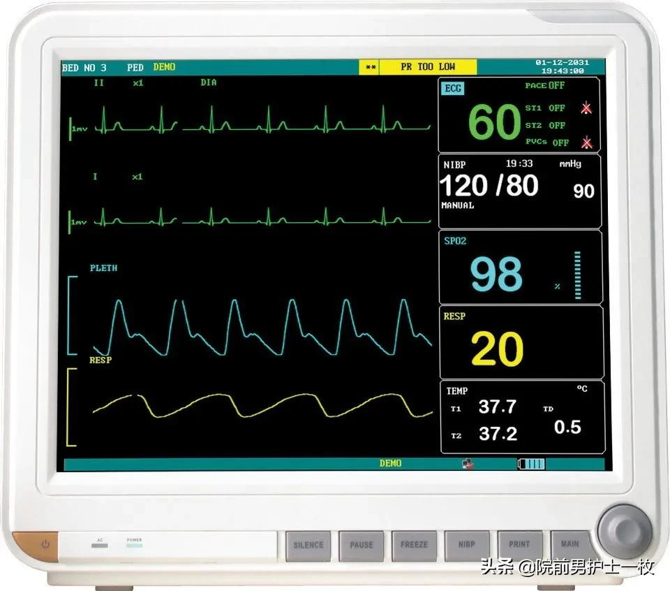 心电监护仪三导联,心电监护仪的使用及维护保养?