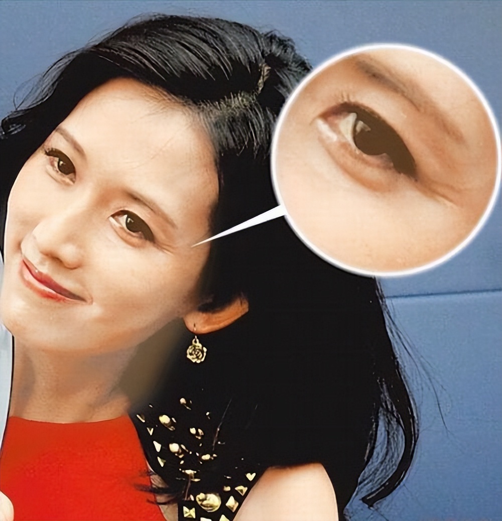 女人开始变老的5个迹象，尤其25岁以上最明显，超过2个就要注意了