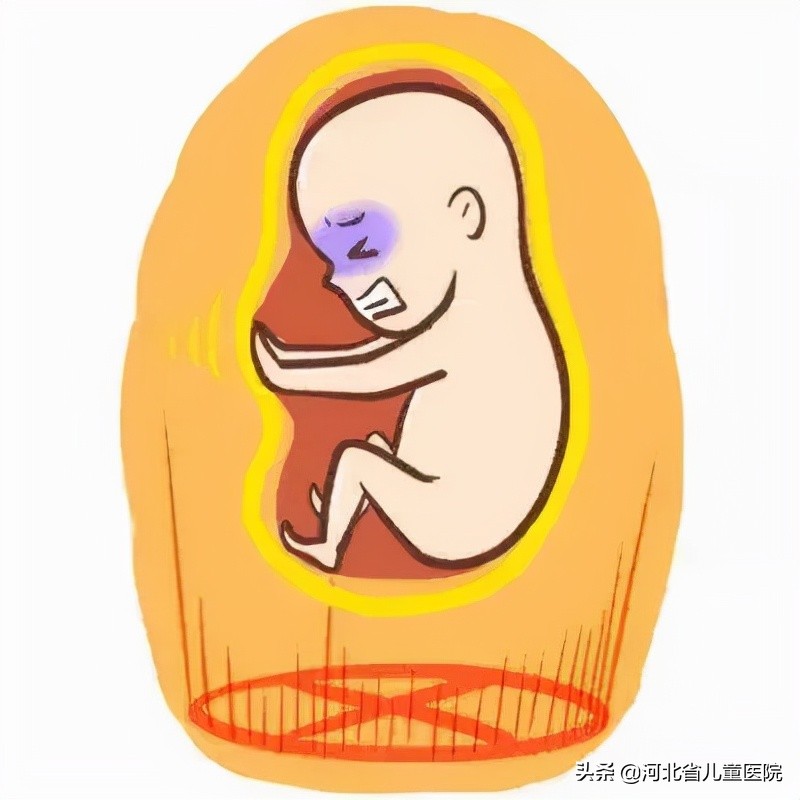 小女孩阴瓣粘连图片(准妈妈) - 赤虎壹号