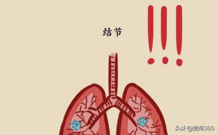 肺结节到底什么原因引发的？了解几个产生的原因，提前避免和预防