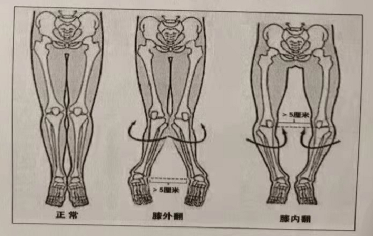 征兵体检：外科最新标准，快来看看自己有没有当兵的潜质！（三）