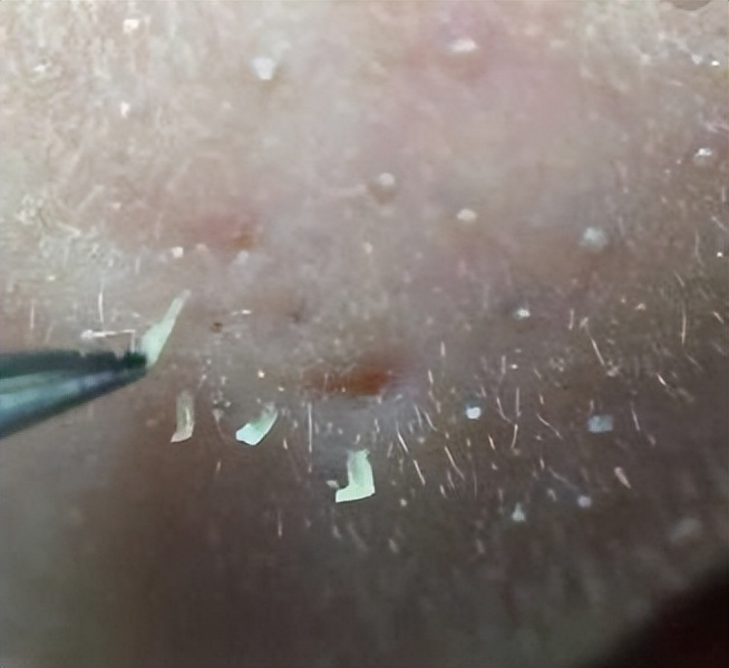 為什么上完粉底液以后，鼻子上有很多白點(diǎn)點(diǎn)？