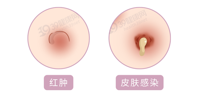 “16岁开始整容，花了400万”：不要命的美，害了多少年轻女孩