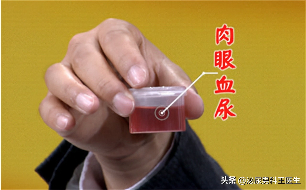 肾好不好，一泡尿就能知晓？若尿液有几种变化，需尽快给肾做检查