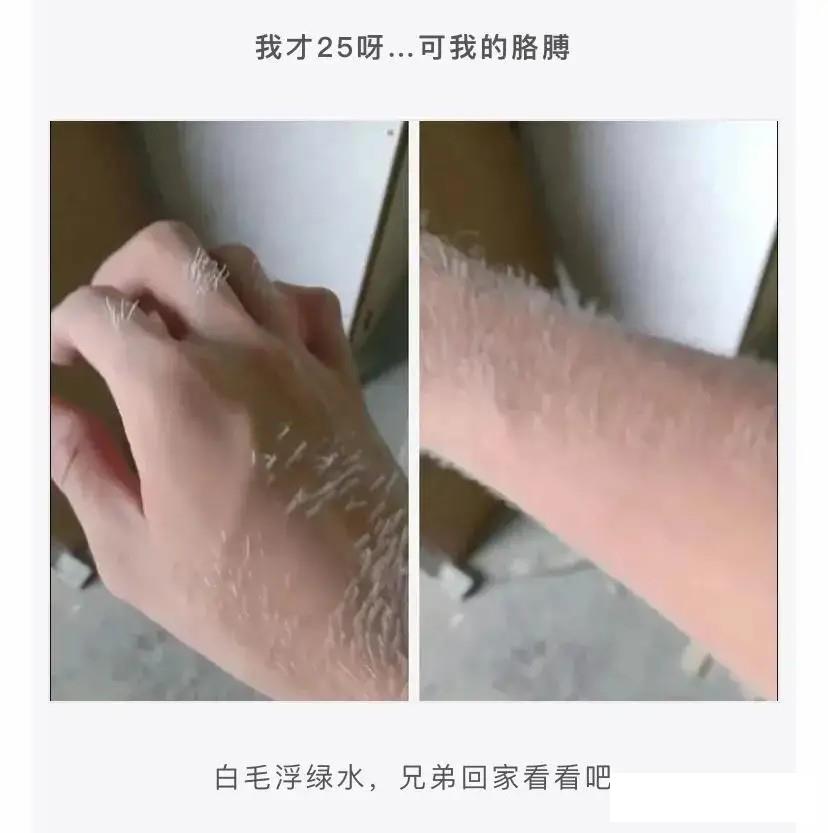 大哥这估计一辈子就不想碰这个东西了吧，你看给你疼的