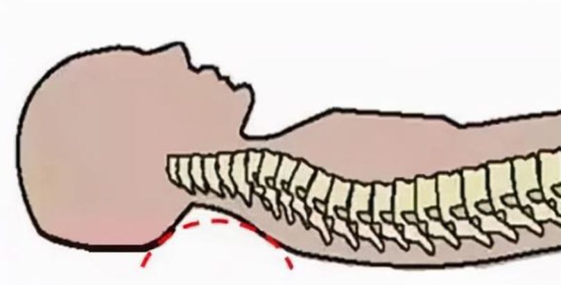 宝宝脊柱特殊，“睡枕头”和“不睡枕头”的宝宝，长大有啥差别？