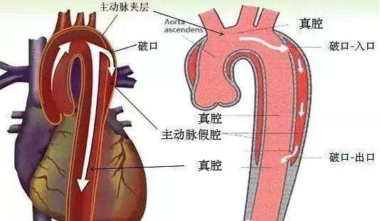 世上最痛的5种病，个个都堪称古代酷刑，经历过的都是超人