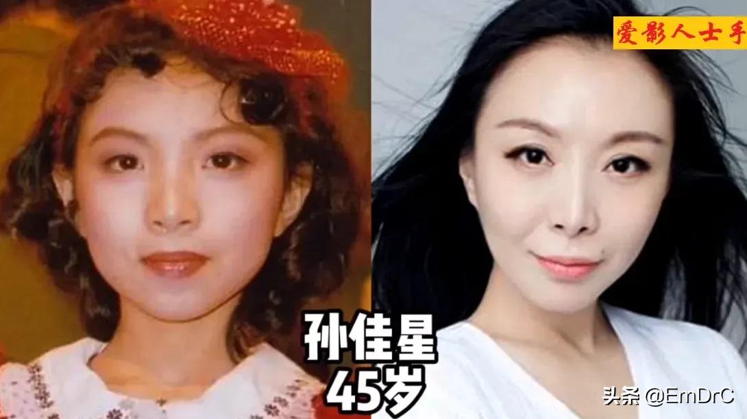 童星长大前后的对比差距很大