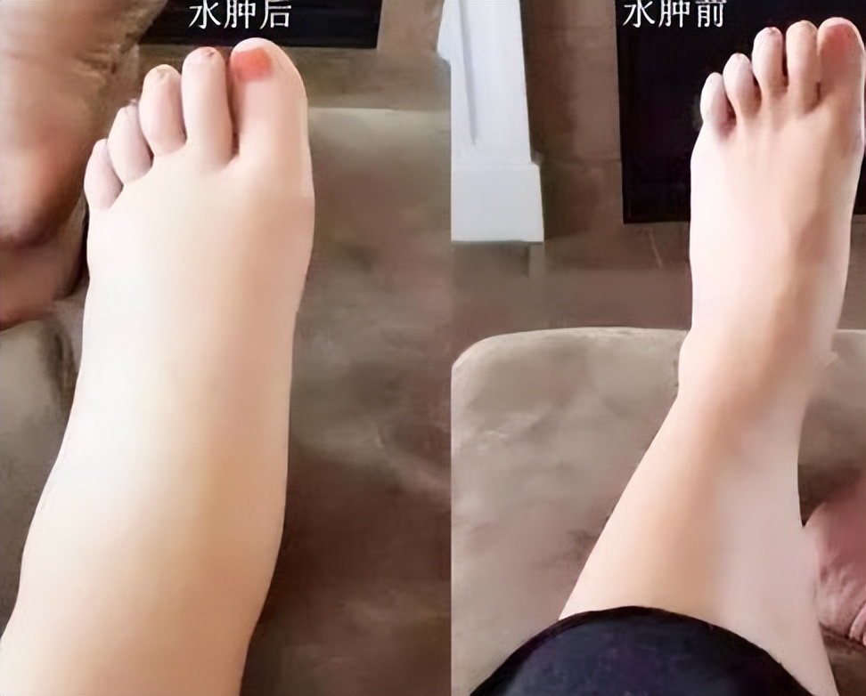 节节草是什么?提醒:老人用它来泡脚,或帮助解决多年"老问题"