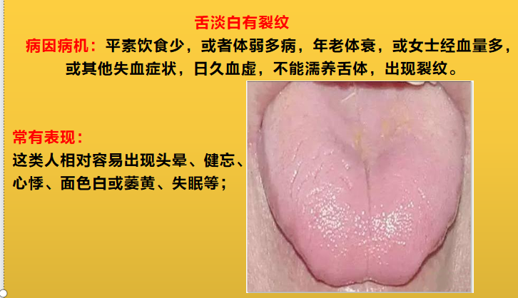 舌头边缘有齿痕，舌苔中间有裂纹？3种齿痕5种裂纹，你是哪一种？